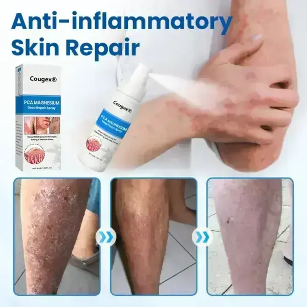 PCA Magnesium Deep Repair Spray - Image 9