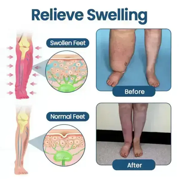 Roll-On Pump Cream for Lymphatic Drainage & Swelling Relief - Image 5