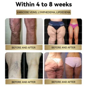 Weight Loss Drops - Image 9