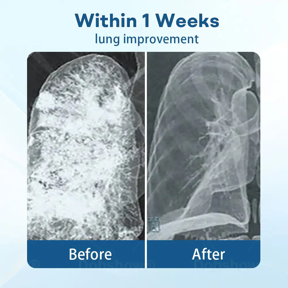 DoubleNano Advanced Lung Detox Patch for Relief - Image 3