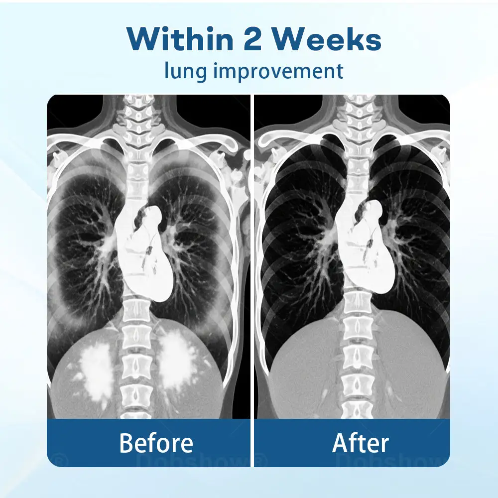 DoubleNano Advanced Lung Detox Patch for Relief - Image 4
