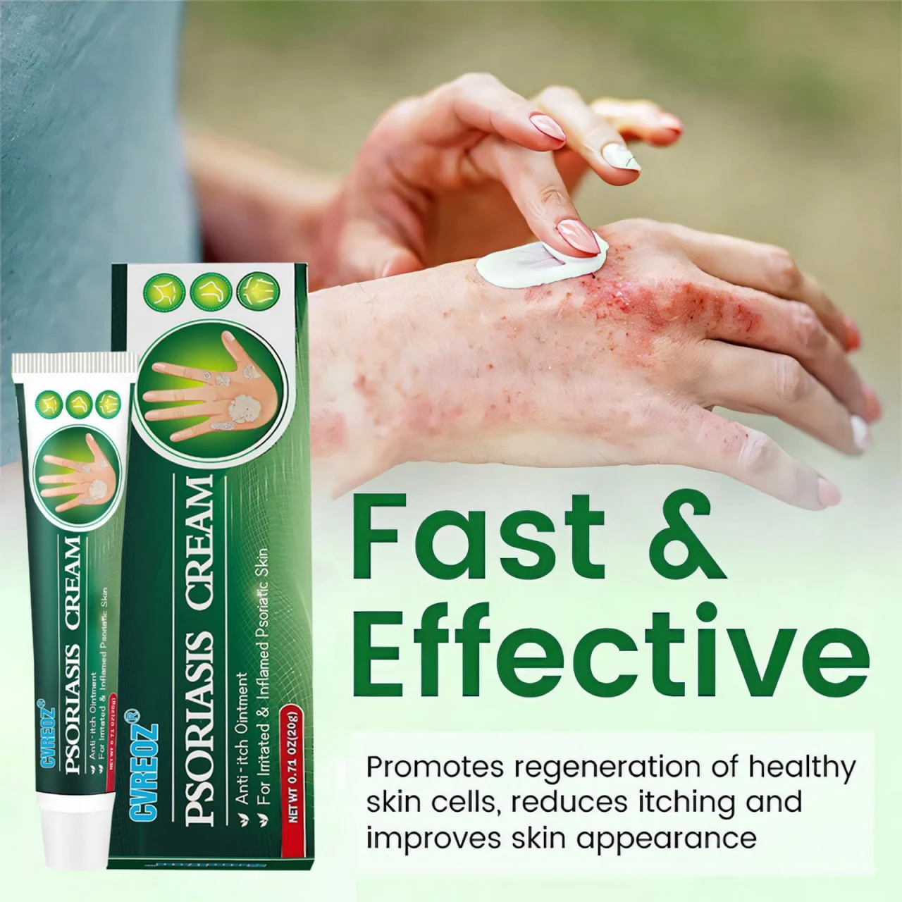 Knotaway Psoriasis Cream - Image 9
