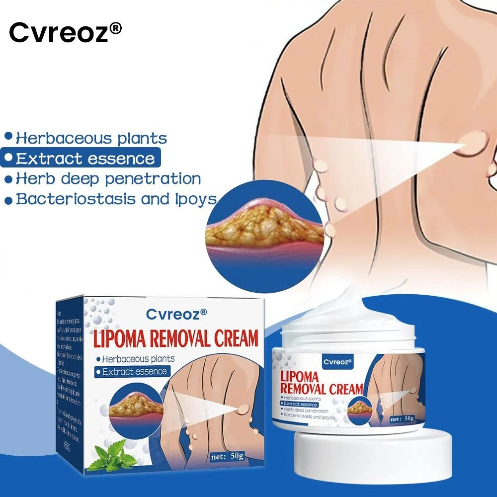 Lipoma Removal Cream