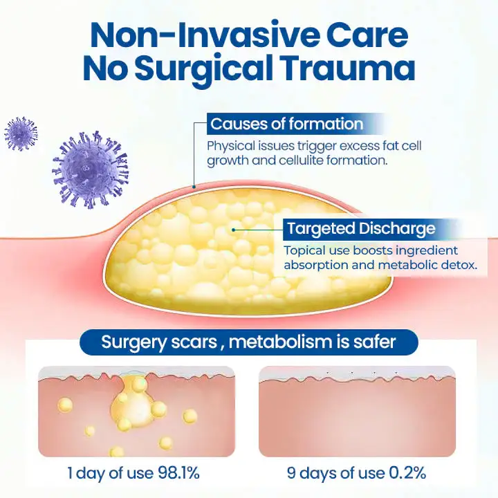 Lipoma Removal Cream - Image 7