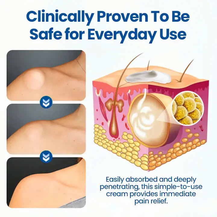 Lipoma Removal Cream - Image 8