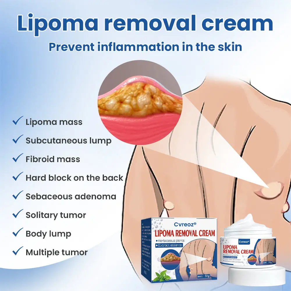 Lipoma Removal Cream - Image 4