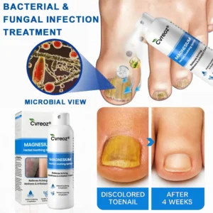 Magnesium Herbal Psoriasis Spray - Image 4