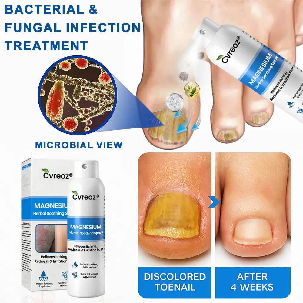 Magnesium Herbal Psoriasis Spray - Image 4