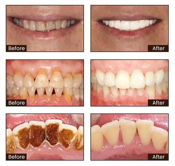 Niacinamide Intensive Whitening Toothpaste - Image 6