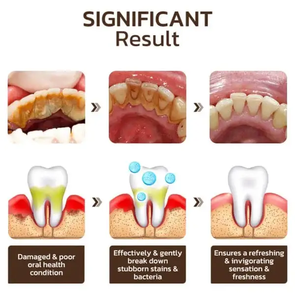 Niacinamide Intensive Whitening Toothpaste - Image 7
