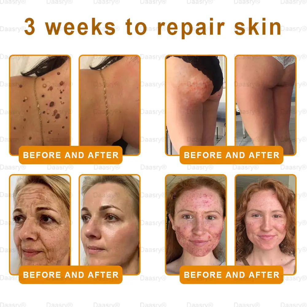 Bee Venom Skin Restoration Cream - Image 2
