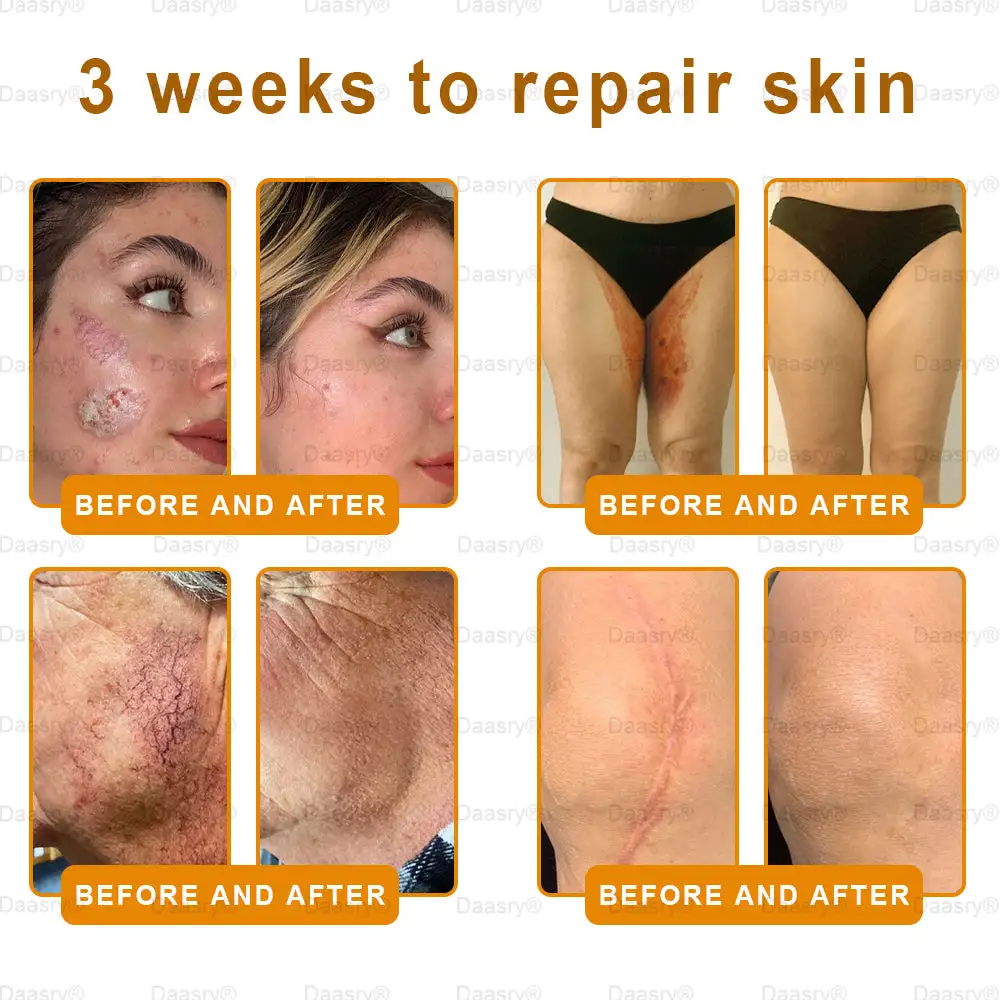 Bee Venom Skin Restoration Cream - Image 3