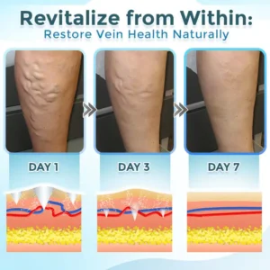 VenaRestore MicroNeedle Vein Repair Patch - Image 5