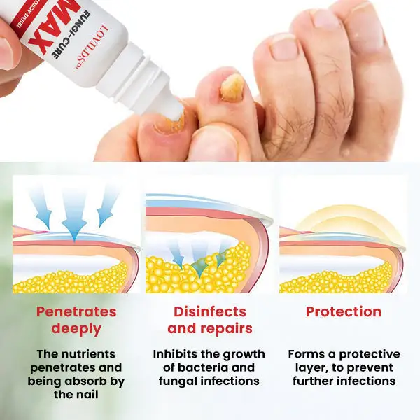 Fungi-Cure Max - Image 5
