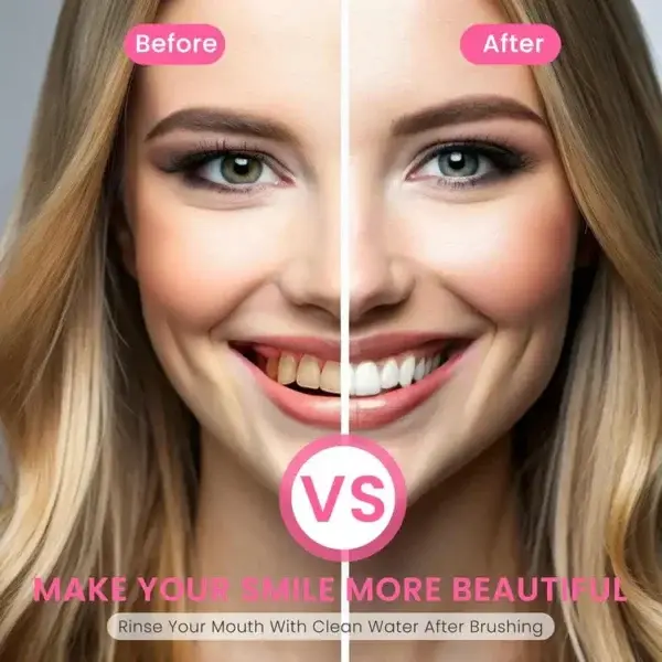 🏆【Max】 Nicotinamide Toothpaste【💎New upgrade Powerful type 10% concentration of Nicotinamide】 - Image 6