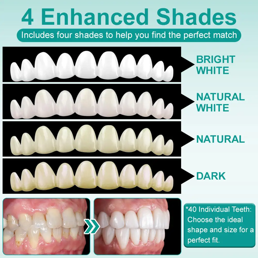 Instant Stick-on Dental Veneers (✅Clinically proven, easy-to-use dental veneers trusted by over 8,000 US users for a comfortable, natural smile.) - Image 7