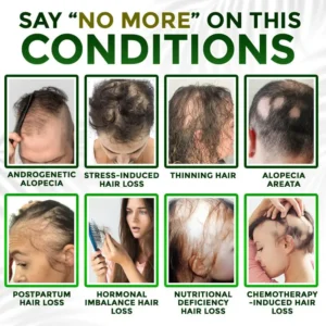 Microneedle Herbal Infusion Hair Stimulation Set - Image 2