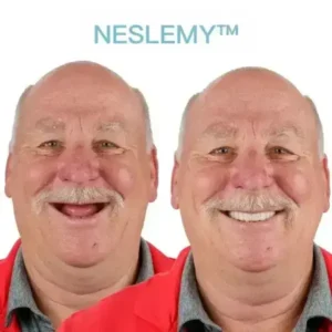 GelFit Dentures - Image 6