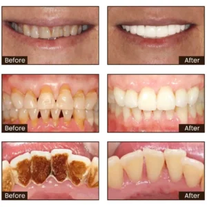 Niacinamide Whitening Toothpaste - Image 6