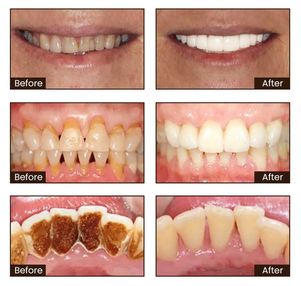 Niacinamide Whitening Toothpaste - Image 6
