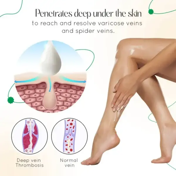 Vein Therapy Cream - Image 10
