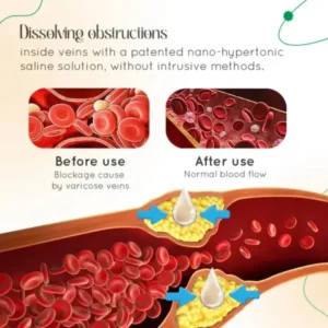 Vein Therapy Cream - Image 12