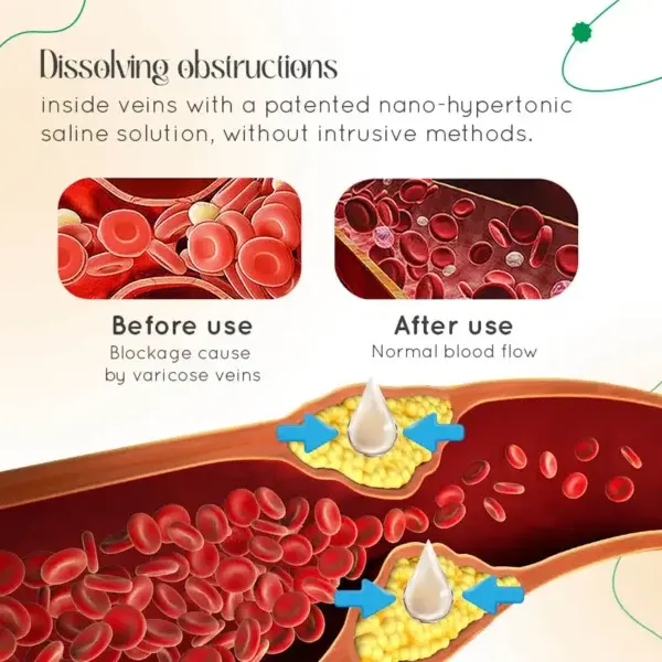 Vein Therapy Cream - Image 12
