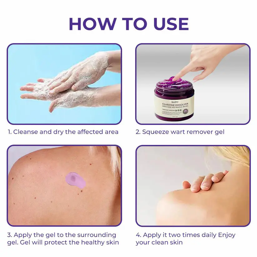 ✅ Official Store: Clarivine Dissolver Mole & Dark Spot Removal Bio-Gel - Image 12