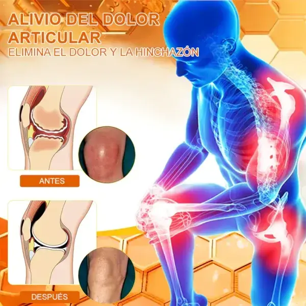 Natural Bee Essences Instant Ultra-Strength Pain Relief Cream - Image 10