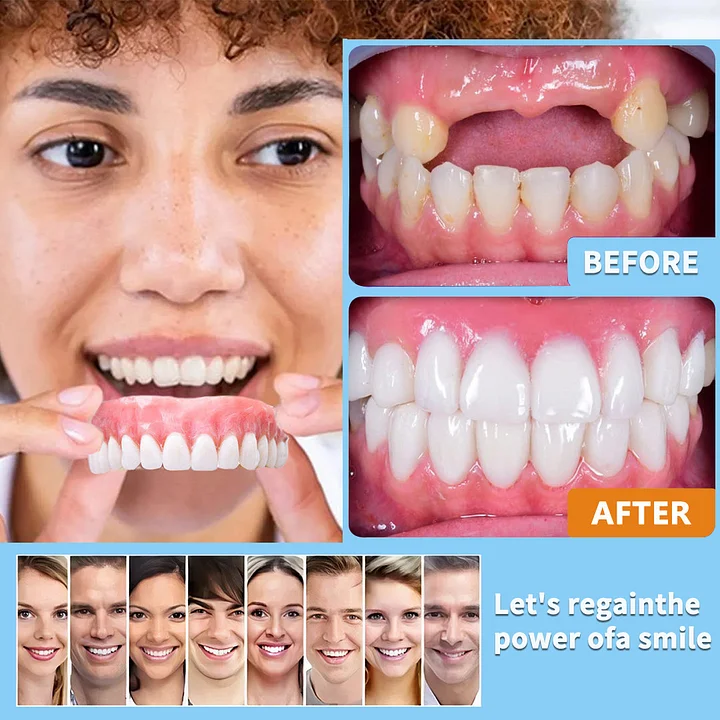 -🦷Advanced Customized Full Denture Set🦷 (⏰Limited time discount last 30 minutes⏰) - Image 7