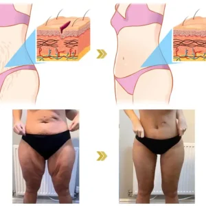 🌸Sealayea® 𝐀𝐝𝐯𝐚𝐧𝐜𝐞𝐝 𝐅𝐢𝐫𝐦𝐢𝐧𝐠 & 𝐖𝐫𝐢𝐧𝐤𝐥𝐞-𝐑𝐞𝐝𝐮𝐜𝐢𝐧𝐠 𝐂𝐫𝐞𝐚𝐦 Pro