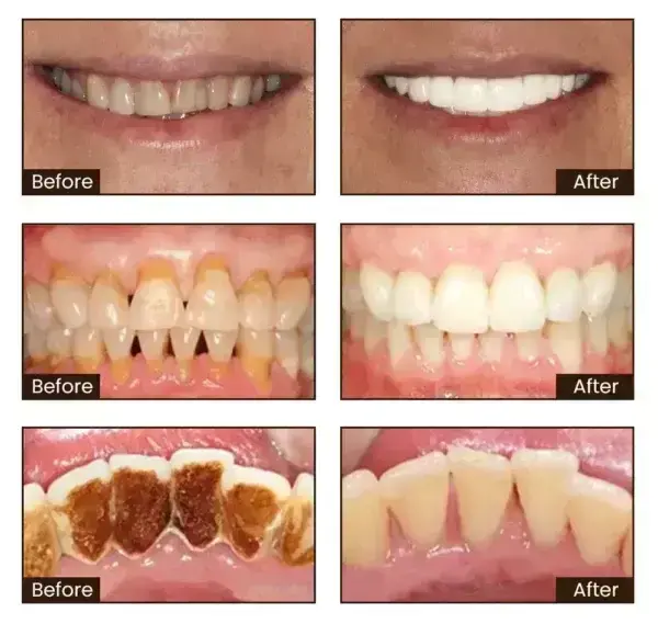 Niacinamide Whitening Toothpaste - Image 14