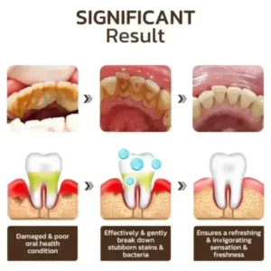 Niacinamide Whitening Toothpaste - Image 15