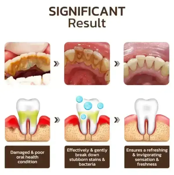 Niacinamide Whitening Toothpaste - Image 15