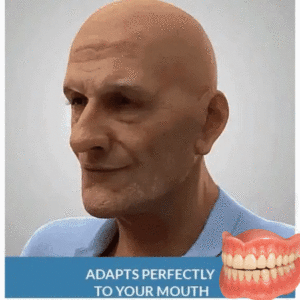 Advanced CustomFit Functional Dentures - Image 8