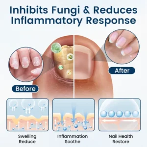 OnyxiGuard Fungal Repair Herbal Spray - Image 3