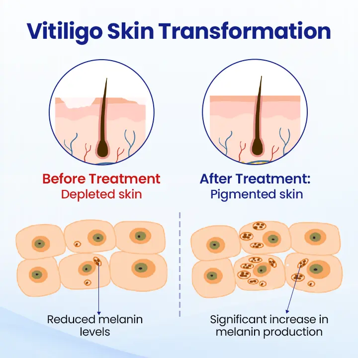 VitiClear Herbal Spray - Image 8