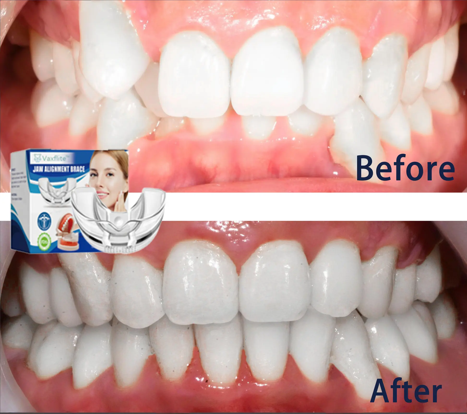 Mandibular Corrector-For a Healthier, More Aligned Smile🦷🔥 - Image 11