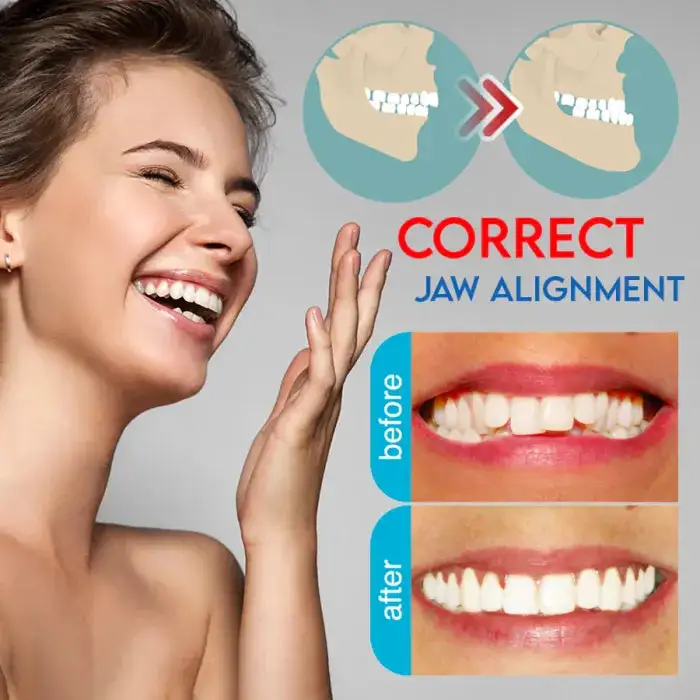 Mandibular Corrector-For a Healthier, More Aligned Smile🦷🔥 - Image 5