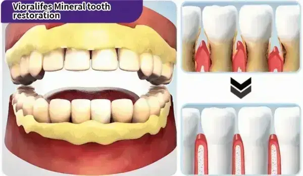 Teeth Restoration Mineral Powder - Image 17