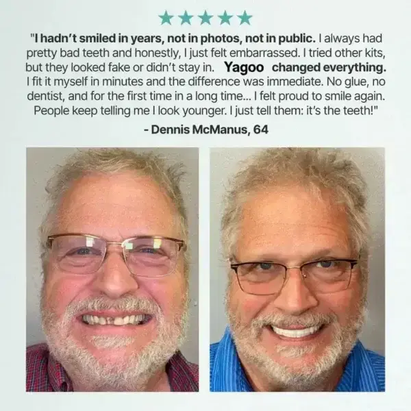 Full Denture with Strong Suction - Image 9