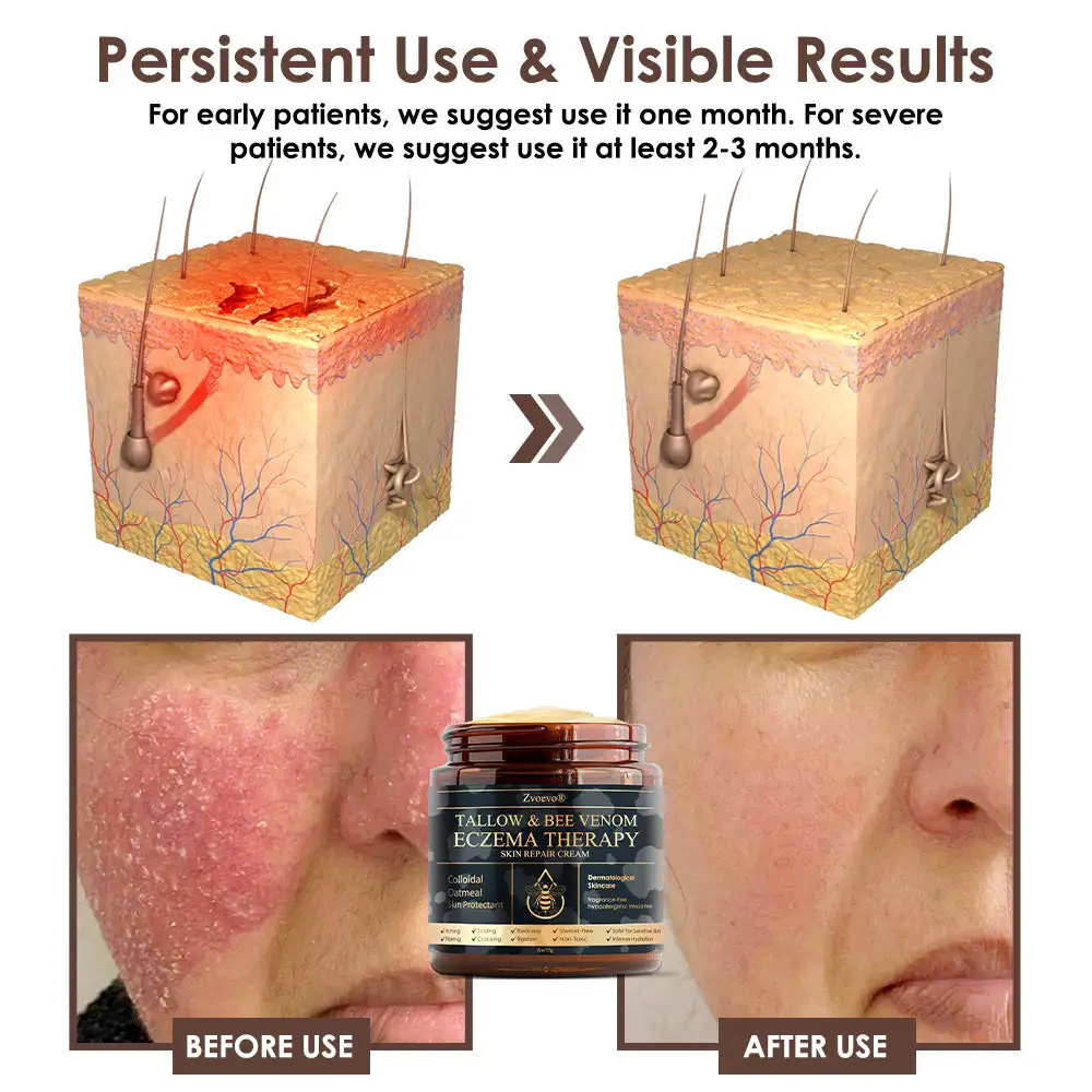 Tallow Bee Venom Skin Restoration Cream - Image 6