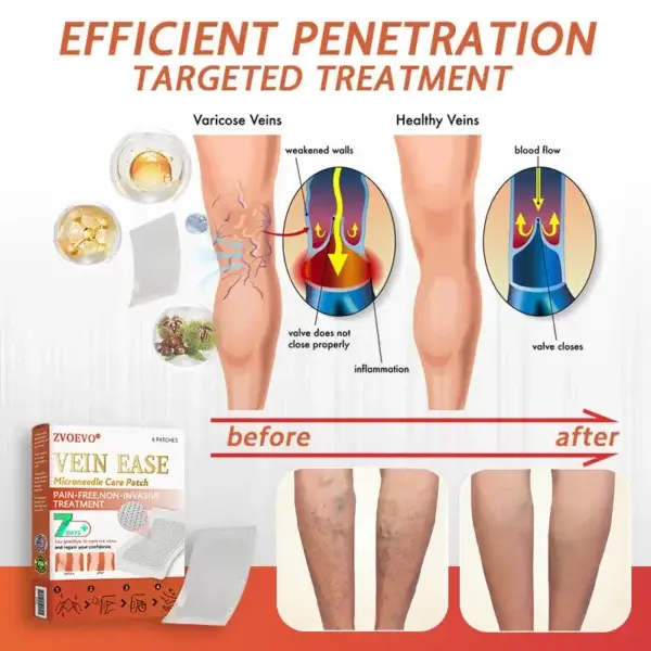 Vein Ease Microneedle Care Patch(For Spider Veins, Varicose Veins, Swelling & Leg Fatigue) - Image 10