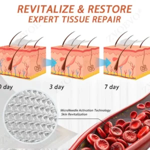 Vein Ease Microneedle Care Patch(For Spider Veins, Varicose Veins, Swelling & Leg Fatigue) - Image 10