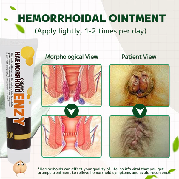 Maximum Strength Hemorrhoids and Fissure Ointment - Image 4