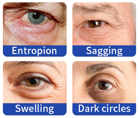 OPENEYES Awaken Peptide Lifting Eye Gel - Image 6
