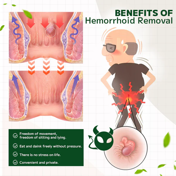 Maximum Strength Hemorrhoids and Fissure Ointment - Image 3