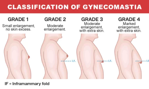 Gynecomastia Cream – Chest Fat Burner - Image 7