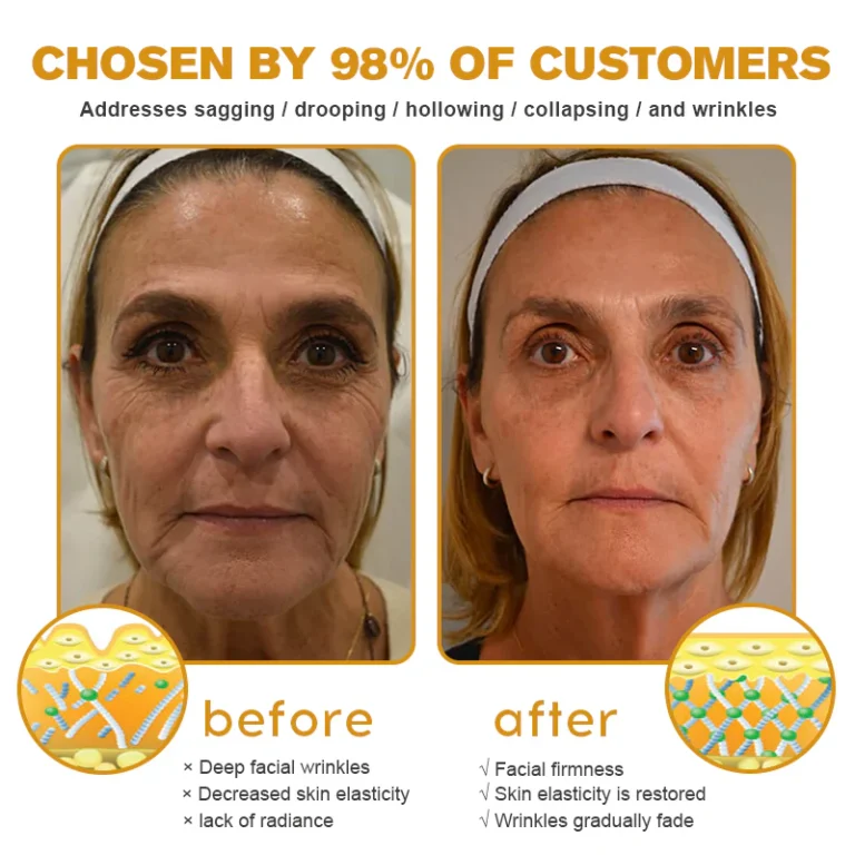Botox Bee Venom Wrinkle Removal Cream - Image 6