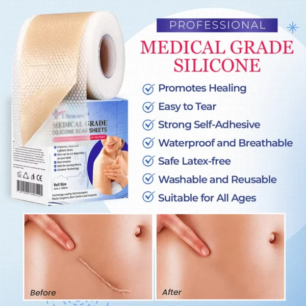 Grade Silicone Scar Sheets - Image 7